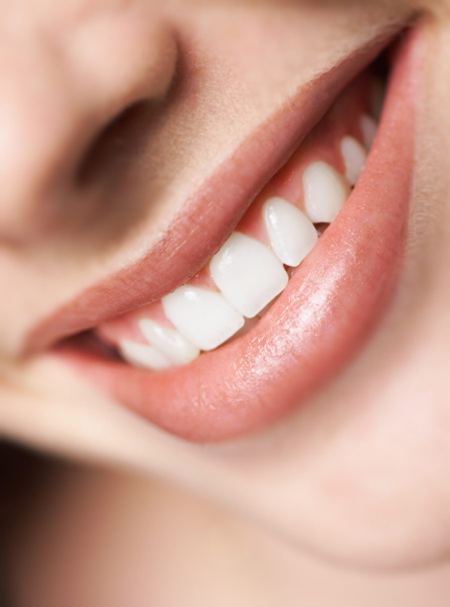 Beautiful smile designed at Smile Design Center
